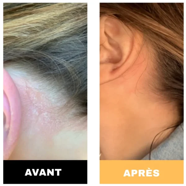 Crème Cicatrisante - Image 3